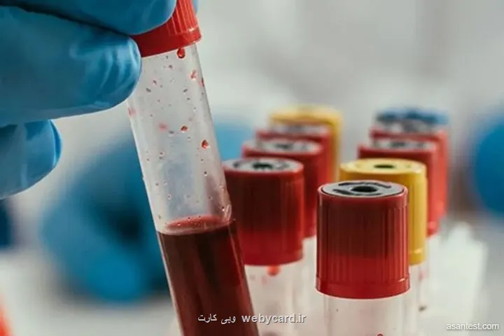 بومی سازی فناوری نوین ژن درمانی برای درمان سرطان خون در ایران